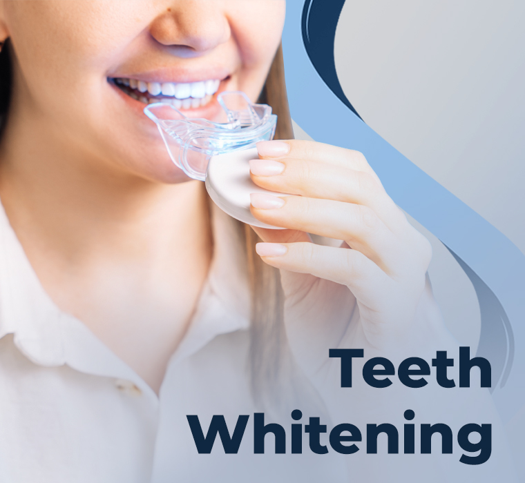 Teeth Whitening
